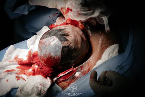 Fotografia de Parto - Newborn - Evelyn Moura Fotografia em Niterói, Rio de Janeiro - ensaio infantil - newborn de recém nascido - partos - parto em niteroi - registro de parto - maternidade são francisco - doce nascer - parto humanizado - andrea barbosa '