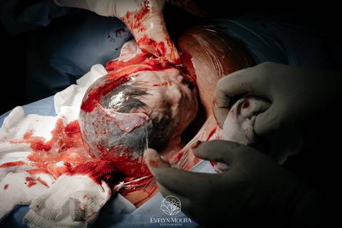 Fotografia de Parto - Newborn - Evelyn Moura Fotografia em Niterói, Rio de Janeiro - ensaio infantil - newborn de recém nascido - partos - parto em niteroi - registro de parto - maternidade são francisco - doce nascer - parto humanizado - andrea barbosa '