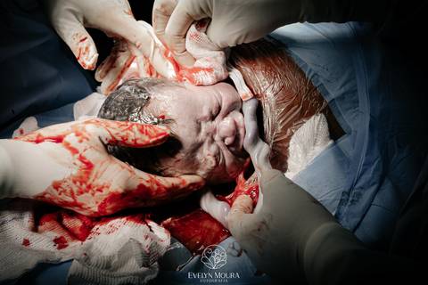 Fotografia de Parto - Newborn - Evelyn Moura Fotografia em Niterói, Rio de Janeiro - ensaio infantil - newborn de recém nascido - partos - parto em niteroi - registro de parto - maternidade são francisco - doce nascer - parto humanizado - andrea barbosa '