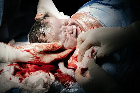 Fotografia de Parto - Newborn - Evelyn Moura Fotografia em Niterói, Rio de Janeiro - ensaio infantil - newborn de recém nascido - partos - parto em niteroi - registro de parto - maternidade são francisco - doce nascer - parto humanizado - andrea barbosa '