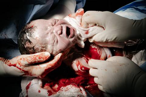 Fotografia de Parto - Newborn - Evelyn Moura Fotografia em Niterói, Rio de Janeiro - ensaio infantil - newborn de recém nascido - partos - parto em niteroi - registro de parto - maternidade são francisco - doce nascer - parto humanizado - andrea barbosa '