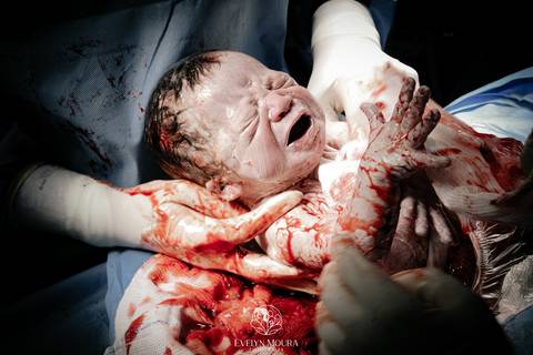 Fotografia de Parto - Newborn - Evelyn Moura Fotografia em Niterói, Rio de Janeiro - ensaio infantil - newborn de recém nascido - partos - parto em niteroi - registro de parto - maternidade são francisco - doce nascer - parto humanizado - andrea barbosa '