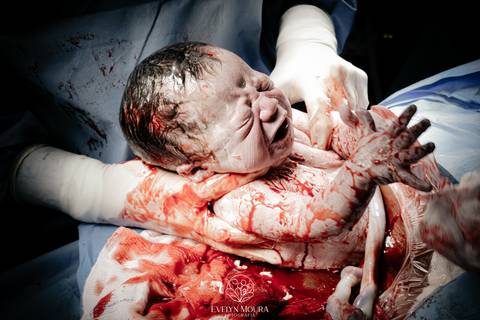 Fotografia de Parto - Newborn - Evelyn Moura Fotografia em Niterói, Rio de Janeiro - ensaio infantil - newborn de recém nascido - partos - parto em niteroi - registro de parto - maternidade são francisco - doce nascer - parto humanizado - andrea barbosa '