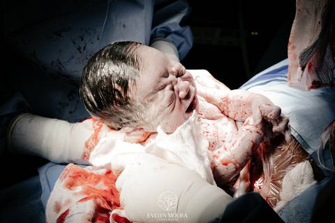 Fotografia de Parto - Newborn - Evelyn Moura Fotografia em Niterói, Rio de Janeiro - ensaio infantil - newborn de recém nascido - partos - parto em niteroi - registro de parto - maternidade são francisco - doce nascer - parto humanizado - andrea barbosa '