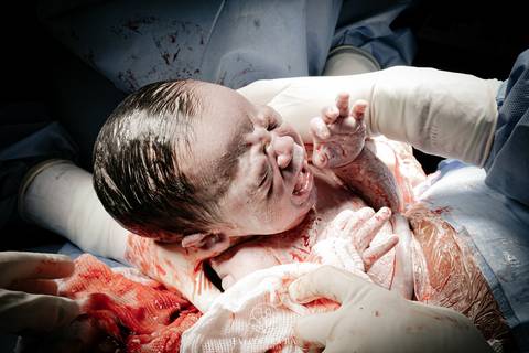 Fotografia de Parto - Newborn - Evelyn Moura Fotografia em Niterói, Rio de Janeiro - ensaio infantil - newborn de recém nascido - partos - parto em niteroi - registro de parto - maternidade são francisco - doce nascer - parto humanizado - andrea barbosa '