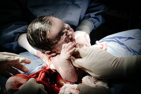 Fotografia de Parto - Newborn - Evelyn Moura Fotografia em Niterói, Rio de Janeiro - ensaio infantil - newborn de recém nascido - partos - parto em niteroi - registro de parto - maternidade são francisco - doce nascer - parto humanizado - andrea barbosa '