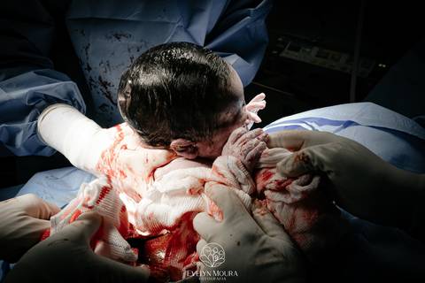 Fotografia de Parto - Newborn - Evelyn Moura Fotografia em Niterói, Rio de Janeiro - ensaio infantil - newborn de recém nascido - partos - parto em niteroi - registro de parto - maternidade são francisco - doce nascer - parto humanizado - andrea barbosa '