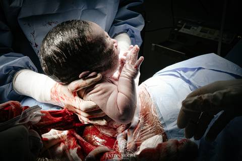 Fotografia de Parto - Newborn - Evelyn Moura Fotografia em Niterói, Rio de Janeiro - ensaio infantil - newborn de recém nascido - partos - parto em niteroi - registro de parto - maternidade são francisco - doce nascer - parto humanizado - andrea barbosa '