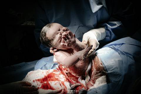 Fotografia de Parto - Newborn - Evelyn Moura Fotografia em Niterói, Rio de Janeiro - ensaio infantil - newborn de recém nascido - partos - parto em niteroi - registro de parto - maternidade são francisco - doce nascer - parto humanizado - andrea barbosa '