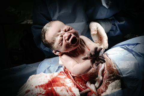 Fotografia de Parto - Newborn - Evelyn Moura Fotografia em Niterói, Rio de Janeiro - ensaio infantil - newborn de recém nascido - partos - parto em niteroi - registro de parto - maternidade são francisco - doce nascer - parto humanizado - andrea barbosa '