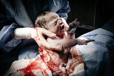 Fotografia de Parto - Newborn - Evelyn Moura Fotografia em Niterói, Rio de Janeiro - ensaio infantil - newborn de recém nascido - partos - parto em niteroi - registro de parto - maternidade são francisco - doce nascer - parto humanizado - andrea barbosa '