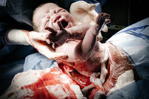 Fotografia de Parto - Newborn - Evelyn Moura Fotografia em Niterói, Rio de Janeiro - ensaio infantil - newborn de recém nascido - partos - parto em niteroi - registro de parto - maternidade são francisco - doce nascer - parto humanizado - andrea barbosa '