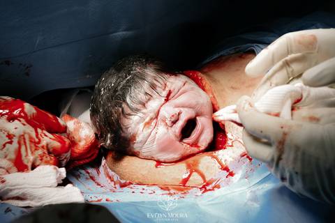 Fotografia de Parto - Newborn - Evelyn Moura Fotografia em Niterói, Rio de Janeiro - ensaio infantil - newborn de recém nascido - partos - parto em niteroi - registro de parto - maternidade são francisco - doce nascer - parto humanizado - andrea barbosa '