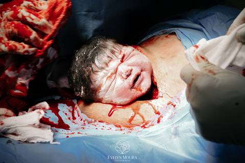 Fotografia de Parto - Newborn - Evelyn Moura Fotografia em Niterói, Rio de Janeiro - ensaio infantil - newborn de recém nascido - partos - parto em niteroi - registro de parto - maternidade são francisco - doce nascer - parto humanizado - andrea barbosa '