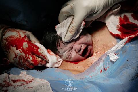 Fotografia de Parto - Newborn - Evelyn Moura Fotografia em Niterói, Rio de Janeiro - ensaio infantil - newborn de recém nascido - partos - parto em niteroi - registro de parto - maternidade são francisco - doce nascer - parto humanizado - andrea barbosa '