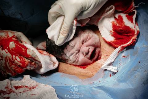 Fotografia de Parto - Newborn - Evelyn Moura Fotografia em Niterói, Rio de Janeiro - ensaio infantil - newborn de recém nascido - partos - parto em niteroi - registro de parto - maternidade são francisco - doce nascer - parto humanizado - andrea barbosa '