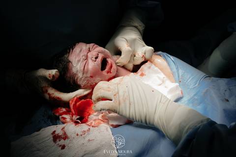 Fotografia de Parto - Newborn - Evelyn Moura Fotografia em Niterói, Rio de Janeiro - ensaio infantil - newborn de recém nascido - partos - parto em niteroi - registro de parto - maternidade são francisco - doce nascer - parto humanizado - andrea barbosa '