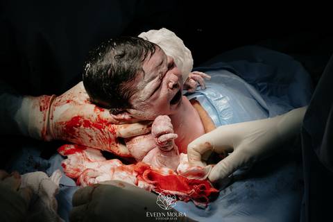 Fotografia de Parto - Newborn - Evelyn Moura Fotografia em Niterói, Rio de Janeiro - ensaio infantil - newborn de recém nascido - partos - parto em niteroi - registro de parto - maternidade são francisco - doce nascer - parto humanizado - andrea barbosa '