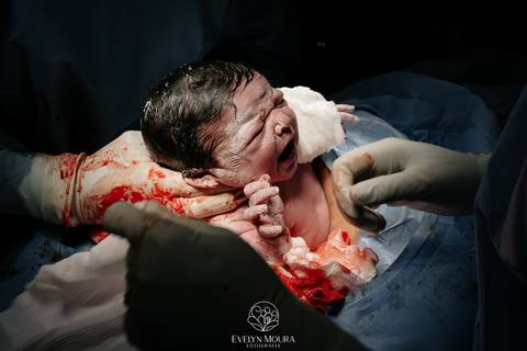 Fotografia de Parto - Newborn - Evelyn Moura Fotografia em Niterói, Rio de Janeiro - ensaio infantil - newborn de recém nascido - partos - parto em niteroi - registro de parto - maternidade são francisco - doce nascer - parto humanizado - andrea barbosa '