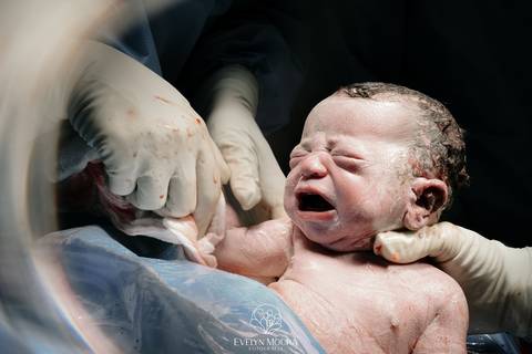 Fotografia de Parto - Newborn - Evelyn Moura Fotografia em Niterói, Rio de Janeiro - ensaio infantil - newborn de recém nascido - partos - parto em niteroi - registro de parto - maternidade são francisco - doce nascer - parto humanizado - andrea barbosa '