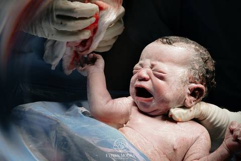 Fotografia de Parto - Newborn - Evelyn Moura Fotografia em Niterói, Rio de Janeiro - ensaio infantil - newborn de recém nascido - partos - parto em niteroi - registro de parto - maternidade são francisco - doce nascer - parto humanizado - andrea barbosa '