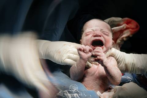 Fotografia de Parto - Newborn - Evelyn Moura Fotografia em Niterói, Rio de Janeiro - ensaio infantil - newborn de recém nascido - partos - parto em niteroi - registro de parto - maternidade são francisco - doce nascer - parto humanizado - andrea barbosa '