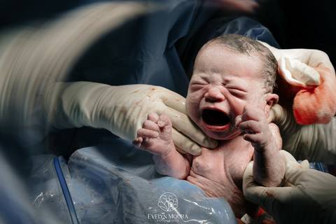 Fotografia de Parto - Newborn - Evelyn Moura Fotografia em Niterói, Rio de Janeiro - ensaio infantil - newborn de recém nascido - partos - parto em niteroi - registro de parto - maternidade são francisco - doce nascer - parto humanizado - andrea barbosa '