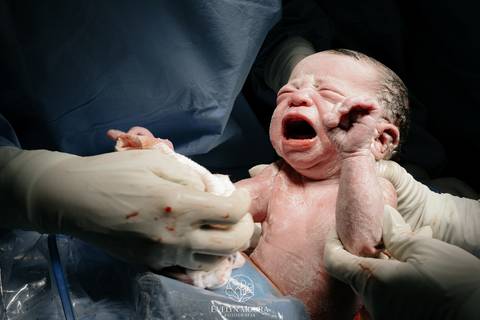 Fotografia de Parto - Newborn - Evelyn Moura Fotografia em Niterói, Rio de Janeiro - ensaio infantil - newborn de recém nascido - partos - parto em niteroi - registro de parto - maternidade são francisco - doce nascer - parto humanizado - andrea barbosa '