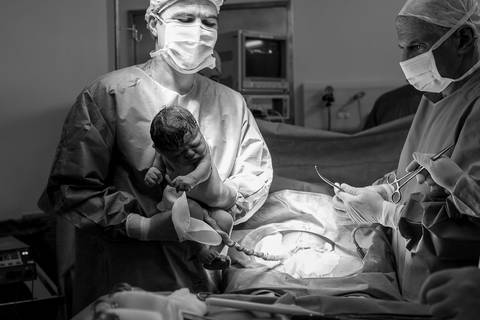 fotografia de parto, fotógrafa de parto, birth photographer, birth photography, cesarean, mãe, pai, família, amigos, casa de saúde são josé, rio de janeiro, maternidade, gestação, últimos minu'