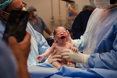 parto, cessaria, mamãe, papai, mãe, pai saúde, família, amor, menina, menino, gravidez, fotografia, barra mansa, volta redonda, rio de janeiro, pediatra, semana, hospital, santa maria, pós parto, Ravi'