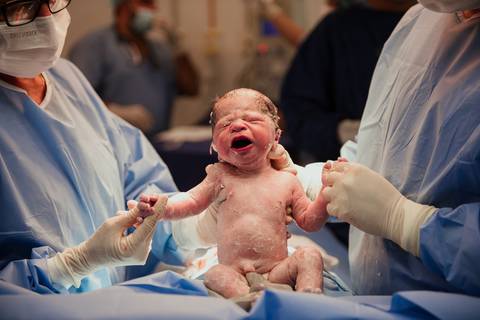 parto, cessaria, mamãe, papai, mãe, pai saúde, família, amor, menina, menino, gravidez, fotografia, barra mansa, volta redonda, rio de janeiro, pediatra, semana, hospital, santa maria, pós parto, Ravi'