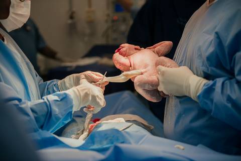 parto, cessaria, mamãe, papai, mãe, pai saúde, família, amor, menina, menino, gravidez, fotografia, barra mansa, volta redonda, rio de janeiro, pediatra, semana, hospital, santa maria, pós parto, Ravi'