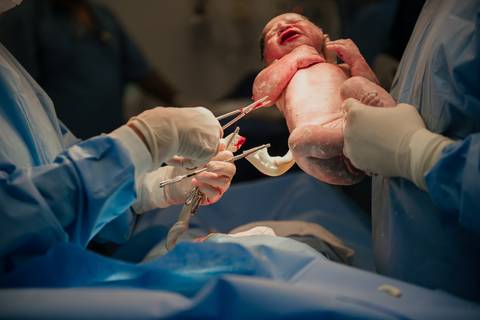 parto, cessaria, mamãe, papai, mãe, pai saúde, família, amor, menina, menino, gravidez, fotografia, barra mansa, volta redonda, rio de janeiro, pediatra, semana, hospital, santa maria, pós parto, Ravi'