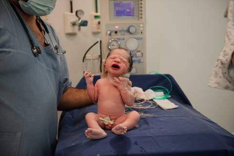 parto, cessaria, mamãe, papai, mãe, pai saúde, família, amor, menina, menino, gravidez, fotografia, barra mansa, volta redonda, rio de janeiro, pediatra, semana, hospital, santa maria, pós parto, Ravi'