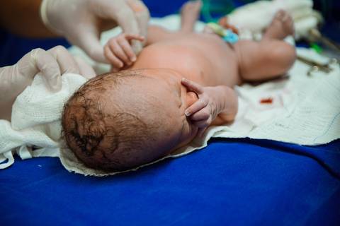 Casa de Saúde Santa Maria Barra Mansa
Parto Menino Fotografo Marcelino Rodrigues '
