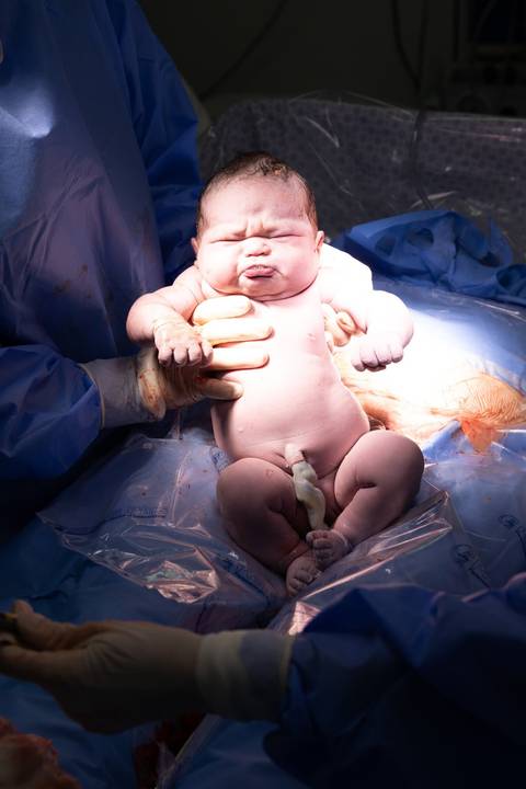 Foto bebê nascendo'