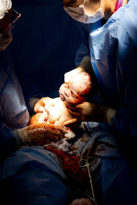 Foto a hora do nascimento'