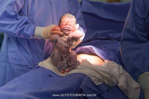 fotografia-de-nascimentos-parto-porto-velho-pvh-ro-hospital-9-de-julho-fotografa-greyce-lene-2019 cesariana'