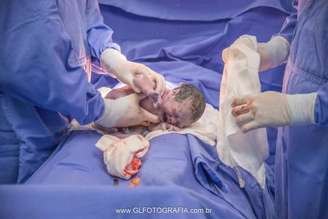 fotografia-de-nascimentos-parto-porto-velho-pvh-ro-hospital-9-de-julho-fotografa-greyce-lene-2019 cesariana'