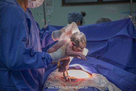 fotografia-de-nascimentos-parto-porto-velho-pvh-ro-hospital-9-de-julho-fotografa-greyce-lene-2019 cesariana'