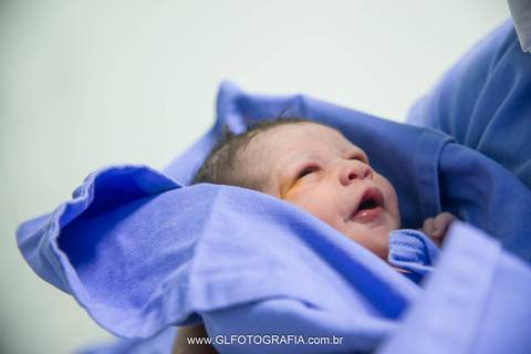 fotografia-de-nascimentos-parto-porto-velho-pvh-ro-hospital-9-de-julho-fotografa-greyce-lene-2019 cesariana'