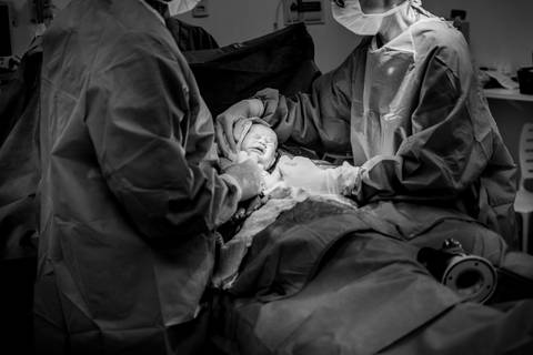 Fotografia Documental de parto realizado no Hospital Metropolitano, Serra - ES.'