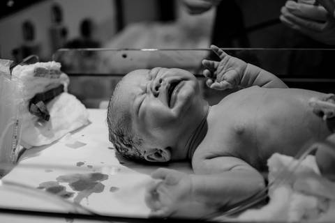 Fotografia documental de parto. Neném recém-nascido.'