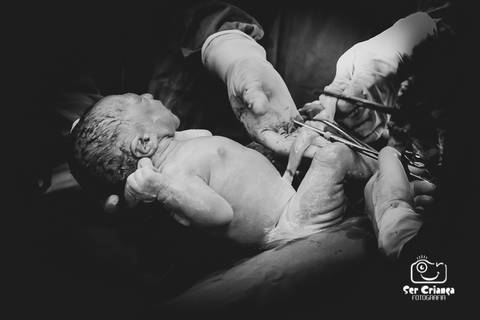 Corte do cordão umbilical em detalhe'