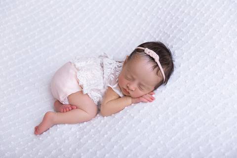 Piebaldismo Brasilia DF Newborn'