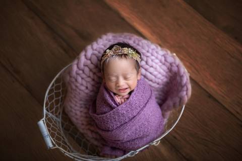 Sorriso composição roxa, bebê newborn Piebaldismo'