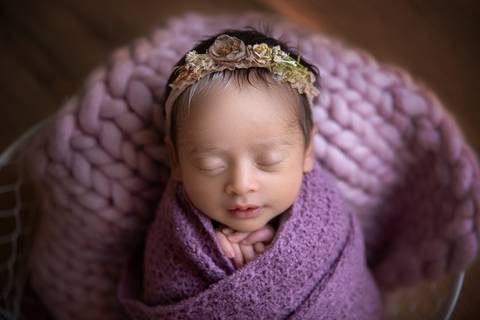 Gabi Aine, Piebaldismo, Brasilia DF, Newborn'