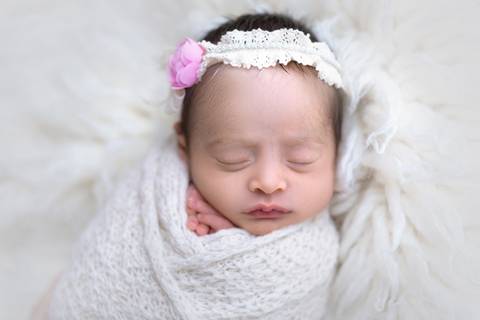 Delixdeza de bebê com Piebaldismo, Brasilia, Gabi Aine'