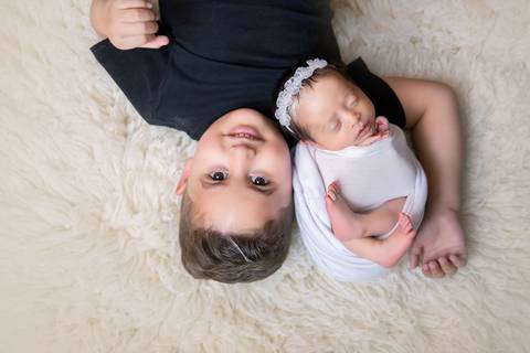 newborn com irmão, Piebaldismo em dose dupla'