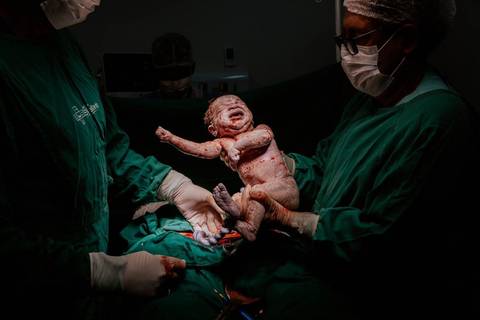 Fotografia de parto'